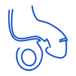 Hypospadias