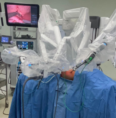 pediatric,-robotic-pyeloplasty,-recovery,-Hyderabad